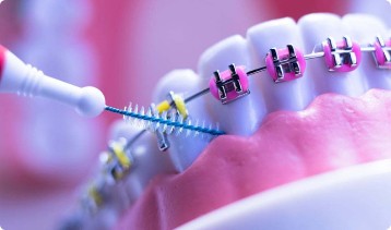 Dr Guedj Paris fiches pratiques hygiene dentaire