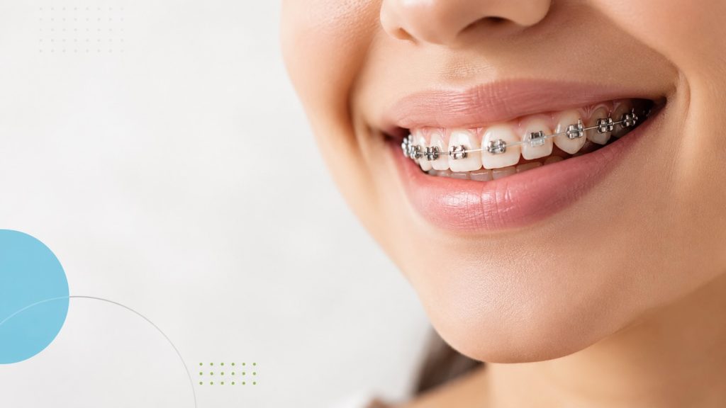 prise en charge orthodontie sécurité sociale - guide Prise en charge orthodontie Sécurité sociale avant 16 ans