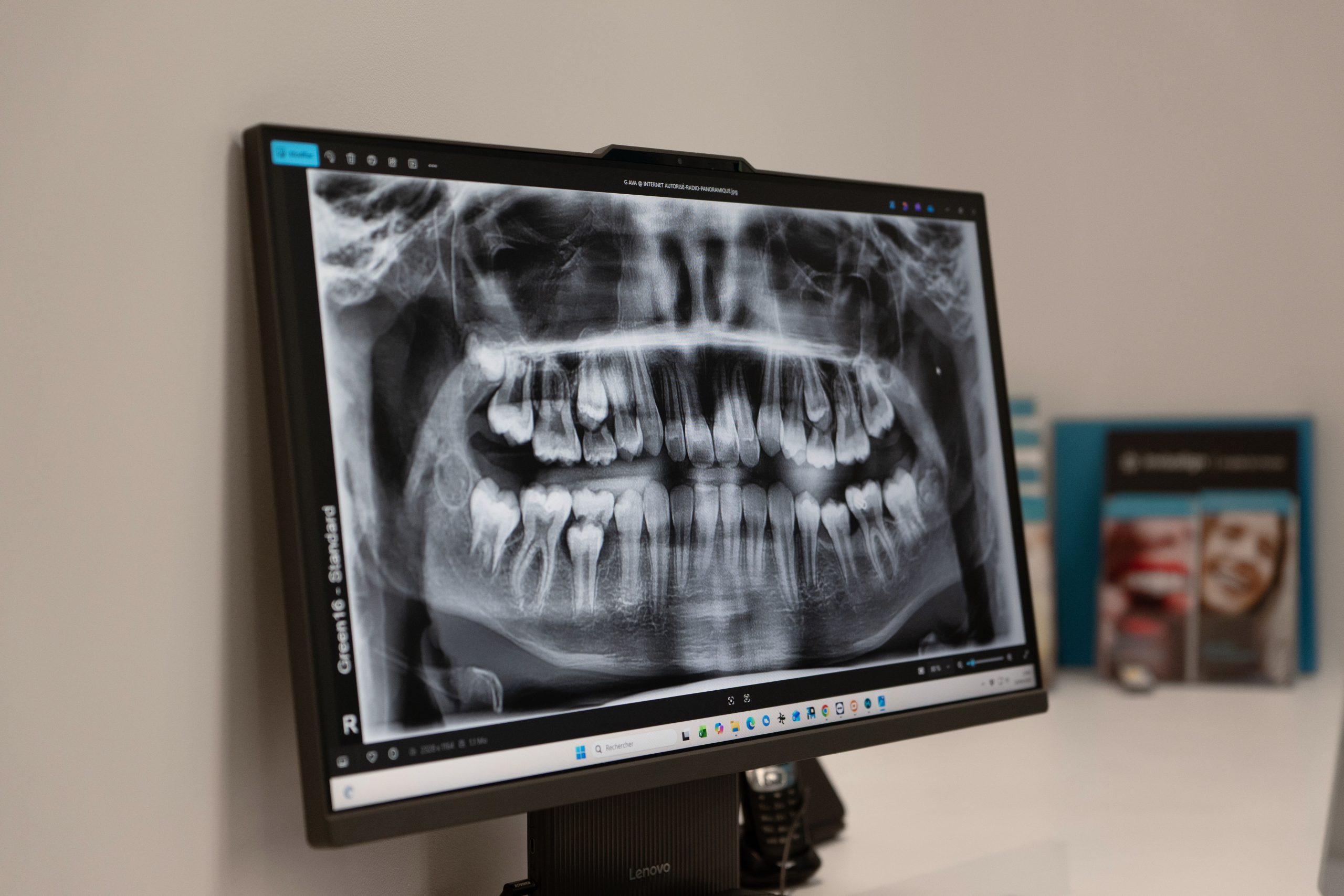 Durée d'un traitement orthodontique enfant | Cabinet Guedj