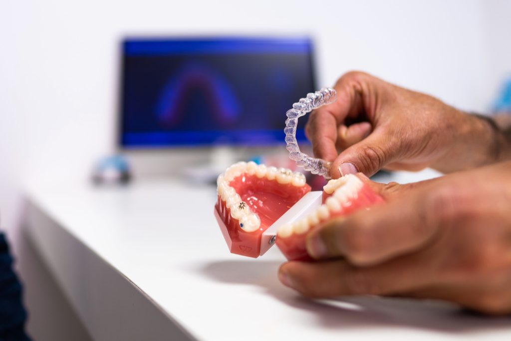 Contention orthodontique fixe ou amovible – Cabinet Guedj