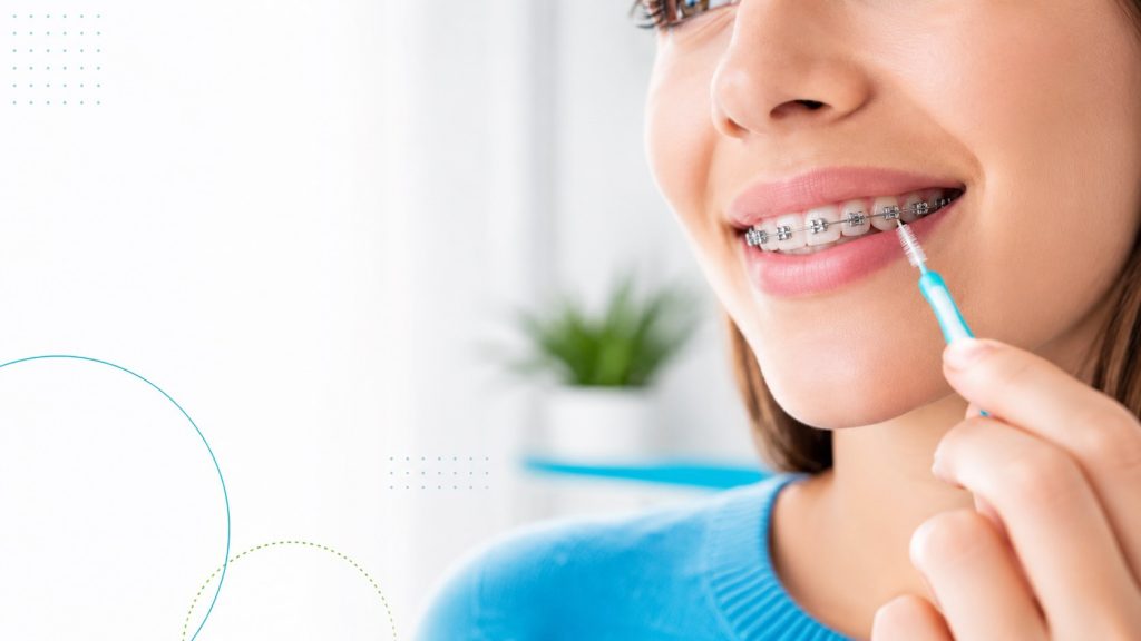 Hygiène dentaire avec appareil orthodontique | Guide